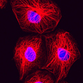 breast cancer cells
